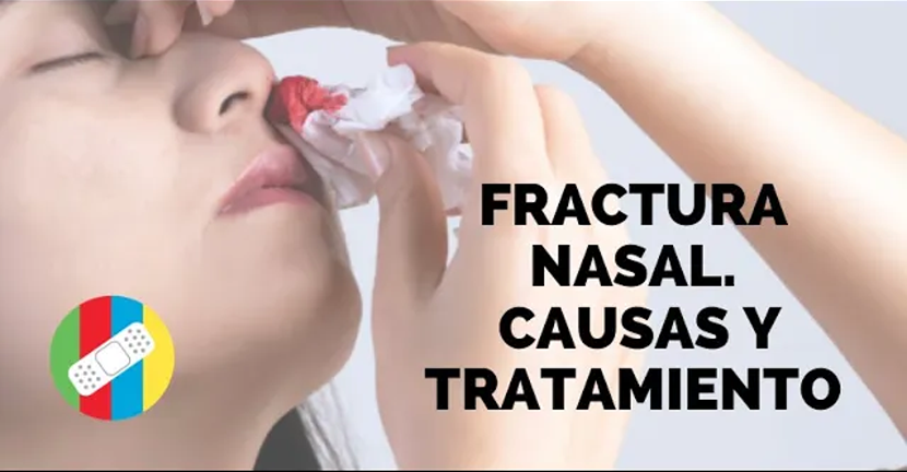 imagen del video FRACTURA NASAL. Causas y tratamiento